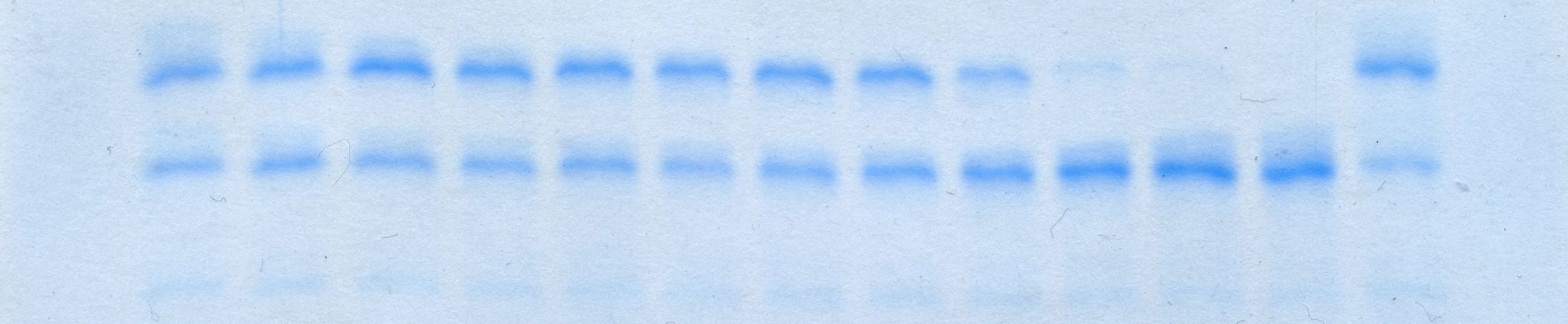 Raw gel scan
